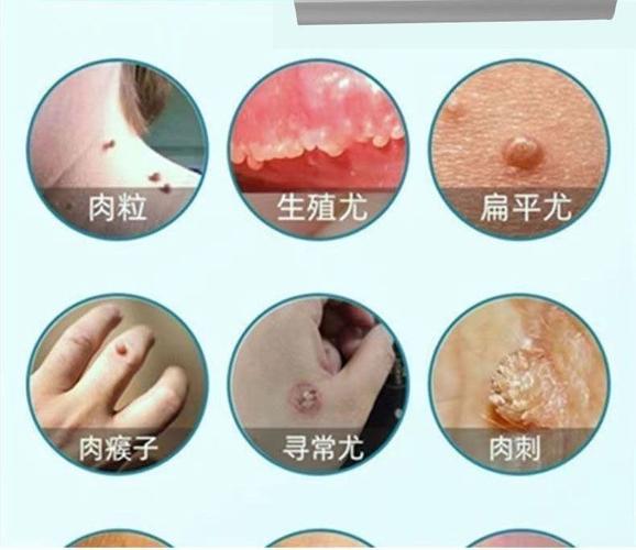 广州宸立生物制品生产厂家资质解析 是否属于特殊用途化妆品及生物制品？